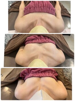 ロココ 岐阜店(Rococo)/驚きのバストアップ!岐阜