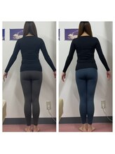 いわき美容整体院/痩身骨盤矯正　産後骨盤矯正