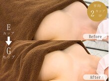 ルルミリ 心斎橋(Lulumili)の雰囲気（最新機器で美しいふっくらバストを目指しましょう！）