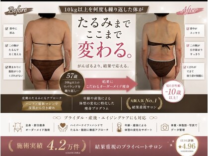 アティレ オオサカ(Attirer Osaka)の写真