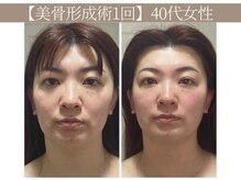 ドクターボディ 恵比寿店(Dr.Body)の雰囲気（【目の開き改善/顔のたるみ/長さ/左右差歪み改善】小顔/恵比寿）