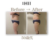虹香(ニコ)の雰囲気（脂肪を冷やして撃退）