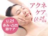 【U-24限定価格/赤み・凸凹改善】アクネ・肌あれケア+毛穴洗浄+肩首￥5500