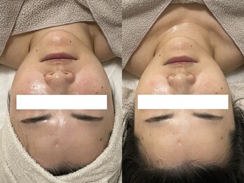 ステムサロン(stem salon)/ビフォーアフター