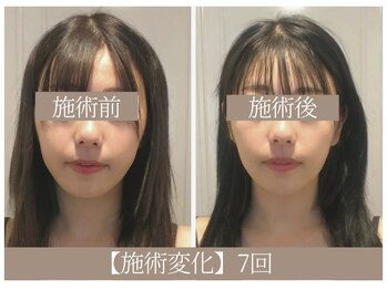 ドクターボディ 恵比寿店(Dr.Body)/【顔の歪み/左右差解消 20代】