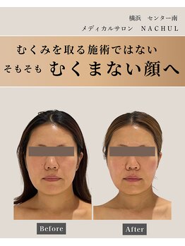 オーク ナチュリ 成城学園前(OAK×NACHUL)/小顔矯正とマシン施術で全身美人