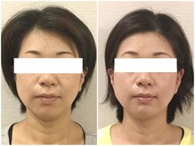 美容整体 ウェリナ 蟹江院/小顔矯正/骨盤矯正/美脚サロン