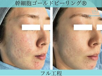 リメイククリニカルビューティー(Remake clinical beauty)/