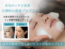 ルナティアラ(LUNAティアラ)