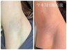 女性【両ワキ脱毛】痛みが少なくリラックスできる★脱毛デビューにも◎