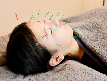 鍼灸マッサージここからの写真/『わたしが行ってもいいのかな…』と迷っている方にこそ受けて欲しい。女性鍼灸師担当のやさしい美容鍼。