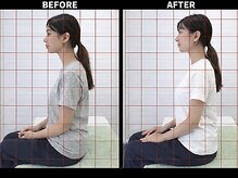 さいとう治療院 新百合ヶ丘/ストレートネック・スマホ首