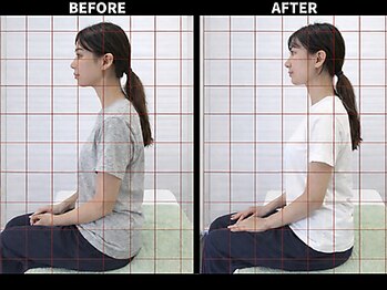 さいとう治療院 新百合ヶ丘/ストレートネック・スマホ首