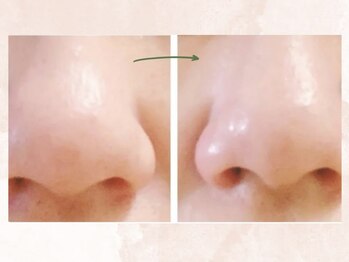 ビジュー(BIJOU)/