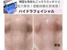 【フェイシャル限定オプション】毛穴角栓◎新ハイドラフェイシャル【30分】