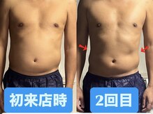 痩身ハイパーナイフメンズ【salon blue rose】新栄町/千種/痩身/ダイエット/脂肪燃焼の雰囲気（結果重視サロン、プロ選手も通うサロン。）
