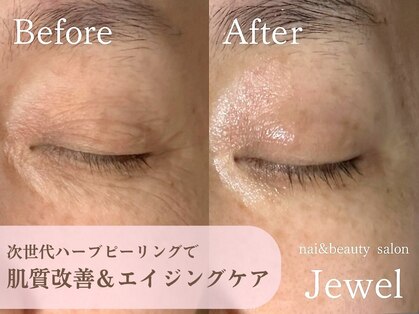 ジュエル(Jewel)の写真