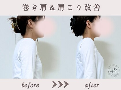 エーアール(AR)の写真