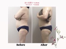 エス(es)/部分集中アプローチ