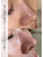 リアルナ(REALUNA)&nbsp;黒ずみ毛穴 毛穴洗浄