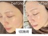 【夏人気No.1◇透明感美白】日焼け.くすみ2トーンUP!10,450→7,500毛穴診断付