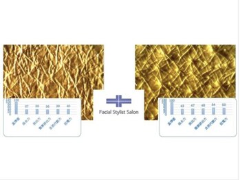 フェイシャルスタイリストサロン 四谷店/ケア例(28)