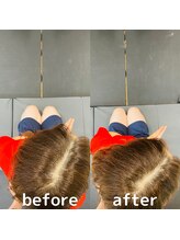 オアボディ(orBody)/姿勢改善ビフォー・アフター16