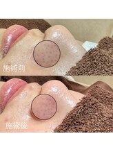 エクラ バイ シャンリィ(eclat by shanLy)/艶肌作り