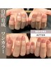 【新規】深爪矯正・美爪育成　長さ出し無し　ワンカラー