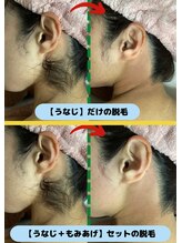 ディスイズミー シュガーリング(This is me Sugaring)/【シュガー】うなじ～もみあげ