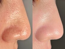 ルーナジェーナ(Luna llena)/池袋/目白/雑司ヶ谷/エステ