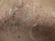 コチカ 恵比寿(KOCKA)の雰囲気（出力・発光時間・当て方等、理論的な施術で高効果◆◇メンズ脱毛）