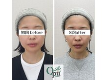 キュープ 鹿児島伊集院店(Qpu)/