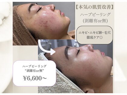 ラヴィン なんばスカイオ店(Lovin)の写真