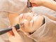 クランシュプール恵比寿鍼灸院の写真/ほうれい線やたるみの改善に！真皮層に刺激し肌の弾力を保つ「ハリウッド式美容鍼」を是非お試し下さい♪