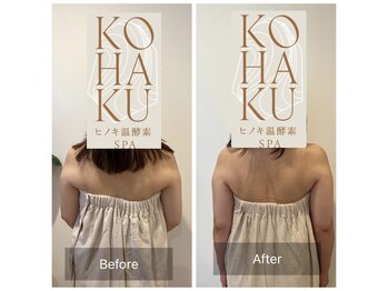 コハク(KOHAKU)/寝て起きたらこんなにスッキリ