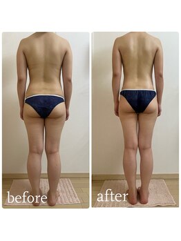 加圧ビューティーサロン スタイル エム(beauty salon style M)/20代/発汗スリミングリンパ120分