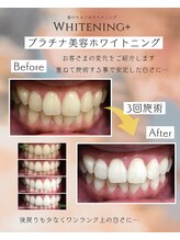 ホワイトニングプラス(Whitening+)/お得なキャンペーン価格