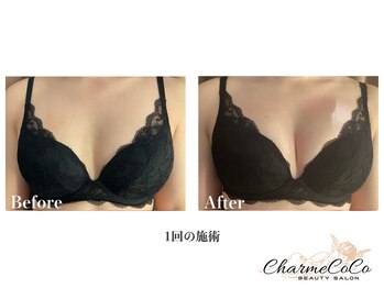 シャルムココ 蔵前店(CharmeCoCo)/ お客様Before→After
