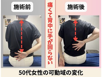 整体院 友(tomo)/肩の可動域制限