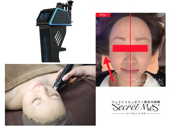 モンシュシュ(Monchouchou)/時短リフトアップ サーマル!