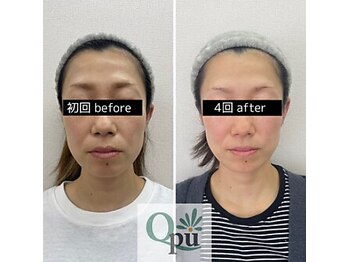 キュープ 鹿児島伊集院店(Qpu)/