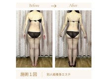 リスキン(Re:Skin)の雰囲気（寝てるだけで若々しく痩せる別人級ハンド技術）