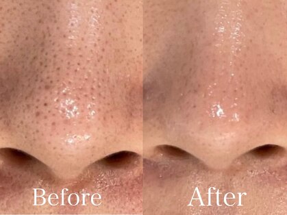 シーベル 小倉の写真