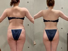 エクセレントビューティーサロン 艶(EN)の雰囲気（唯一無二のBODY形成・サイズダウン減量プログラム）