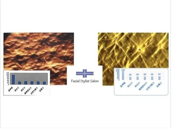 フェイシャルスタイリストサロン 四谷店/ケア例 (29)