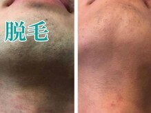 レディース ビホウ(BIHOU)/