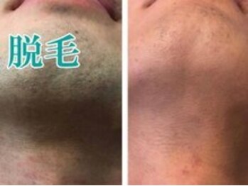 レディース ビホウ(BIHOU)/