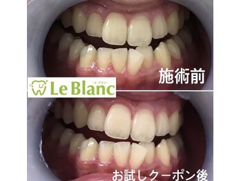 ルブラン 奈良店(Le Blanc)/当店の特徴