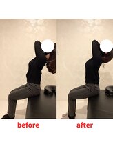 ナオル整体 福岡香椎院(NAORU整体)/20代女性施術事例【猫背】